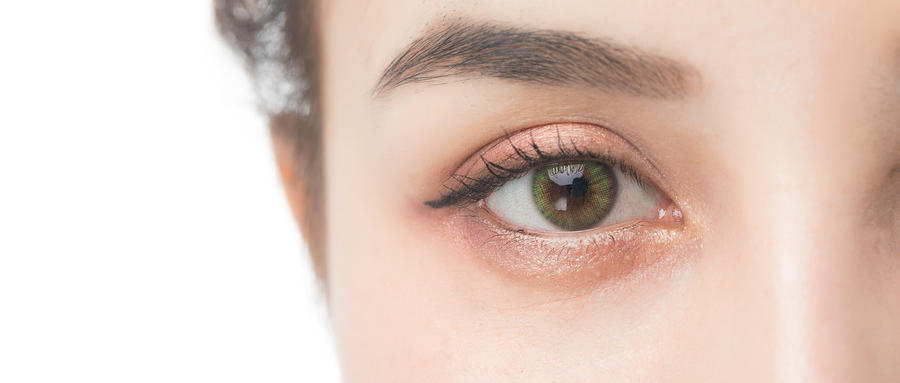 內(nèi)眥贅皮的早期癥狀有哪些？